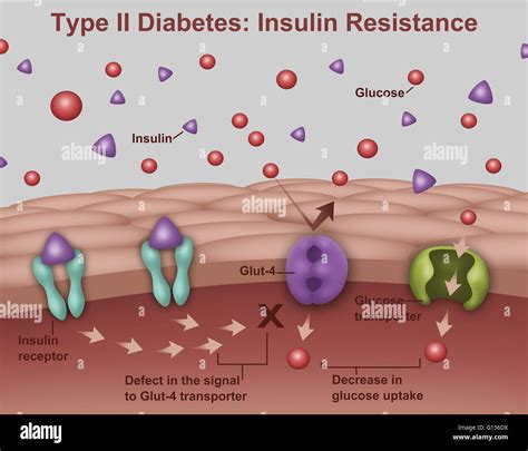 llustration of insulin and glucose production in Type 2 diabetes ...