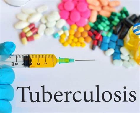 Stay safe from the dangers of Tuberculosis | stay safe from the dangers ...