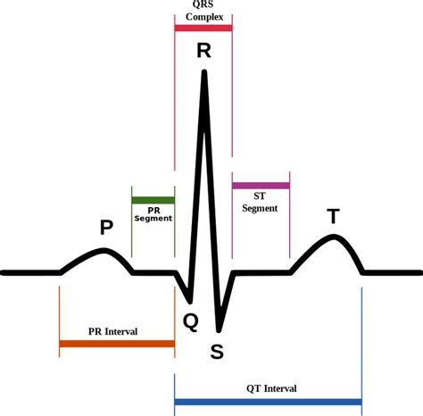 Image result for PR Interval Normal Range