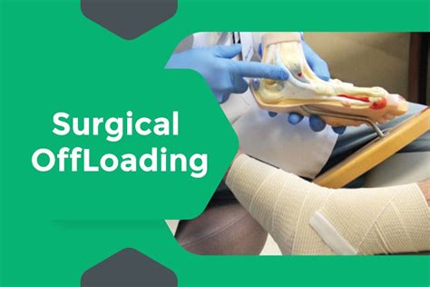 Surgical OffLoading Treatment | Care for Diabetic Foot Ulcer