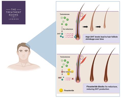 Anagen Follicles Regrowth Cycles & All You Need to Know