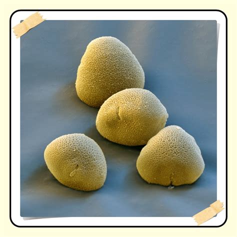 Image result for Flower Pollen Under Microscope