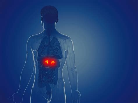 Cushing Disease