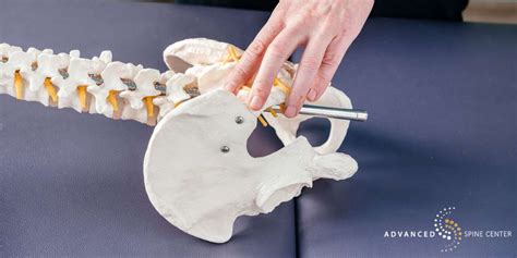 Image result for SI Joint Injection Procedure