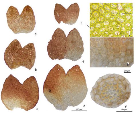 Marsupella lusitanica (Gymnomitriaceae, Marchantiophyta), a New Species ...