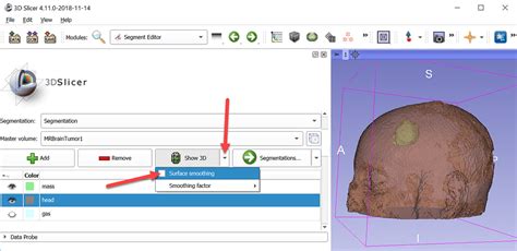 Image result for 3D Slicer Segmentation Tutorial