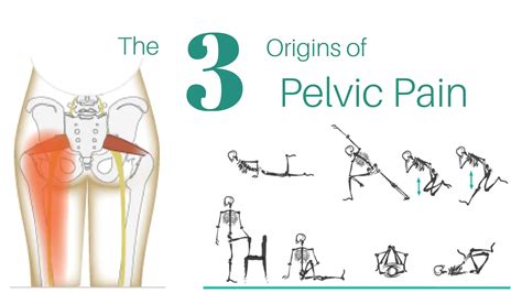 Butt Pain: How Yoga Can Help