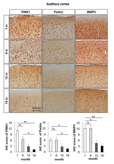 Age-Related Hearing Loss in C57BL/6J Mice Is Associated with Mitophagy ...
