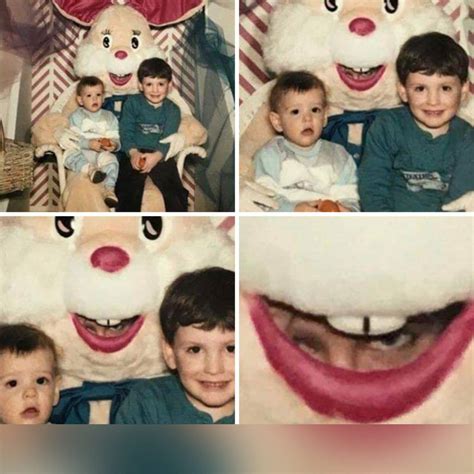 खरगोश के होठों के बीच दांत की जगह दिखने लगी आंखे, गौर करने पर फोटो ...