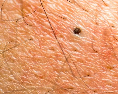 Bildergebnis für effloreszenz