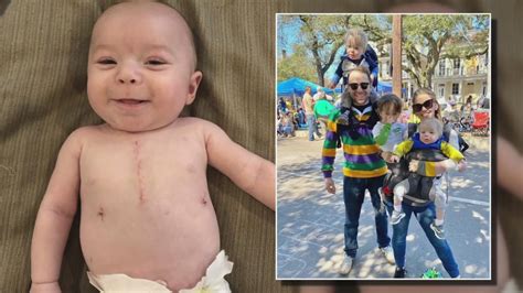 Child born with a hole in his heart thriving thanks to Mardi Gras miracle | wwltv.com