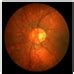 CAS-UNet: A Retinal Segmentation Method Based on Attention