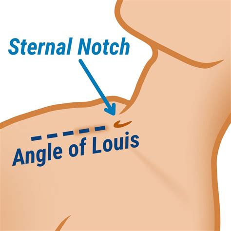 Jugular Vein Pulsation - Delaware Vein Center