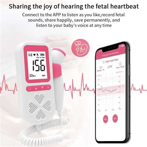 Baby Heartbeat Monitor with Mobile App Phone - shopZtop