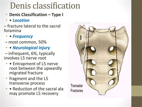 Sacral fracture | PPTX