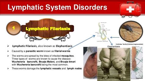 Image result for Lymphatic System Disorders