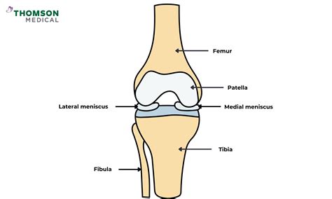 Torn Meniscus: What It Feels Like, Symptoms, Diagnosis & Recovery | Thomson Medical