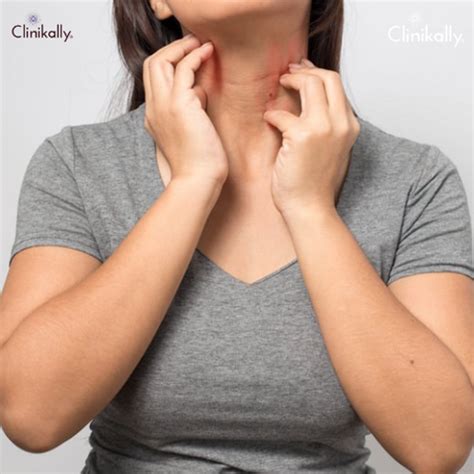 How Anxiety Medication Can Affect Your Skin | Clinikally