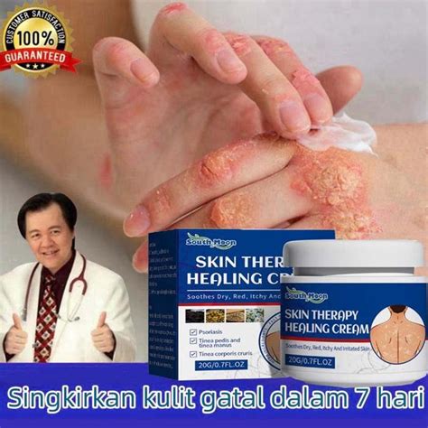 Promo Salep gatal paling ampuh obat gatal obat eksim salep gatal ...