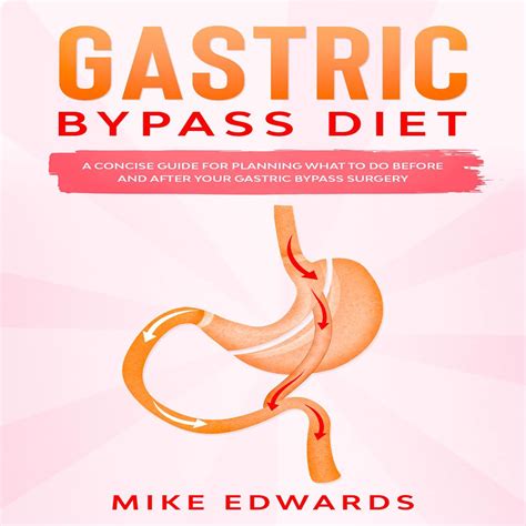 Gastric Bypass Diet: A Concise Guide for Planning What to Do Before and After your Gastric ...
