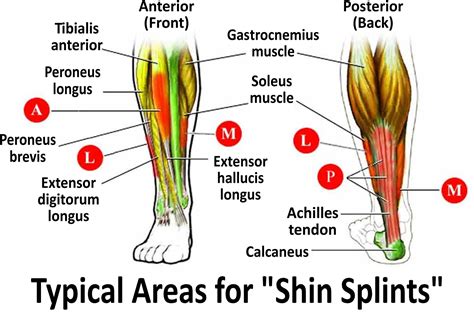 Shin Splints Inner Leg at Donald Altman blog