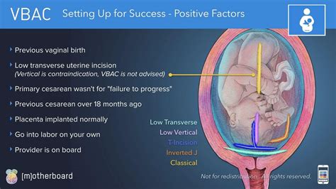Preparing for a VBAC: 7 Helpful Tips (2022) — Motherboard Birth