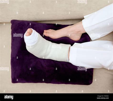 Broken leg in white plaster cast lying on purple pillow. Home ...