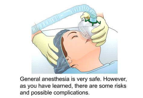 General Anesthesia Full Procedure 的图像结果