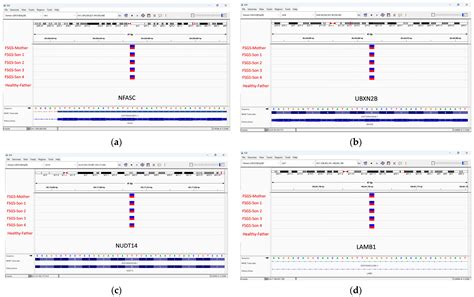 Identification of Genes Associated with Familial Focal Segmental ...