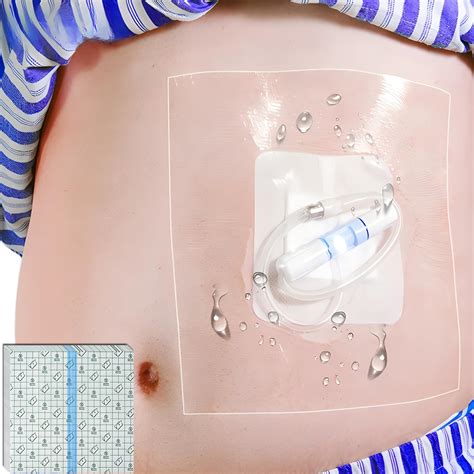 POSTOPMEDICALWEAR Dialysis Catheter Shower Cover | 8x8 Inch Shower ...