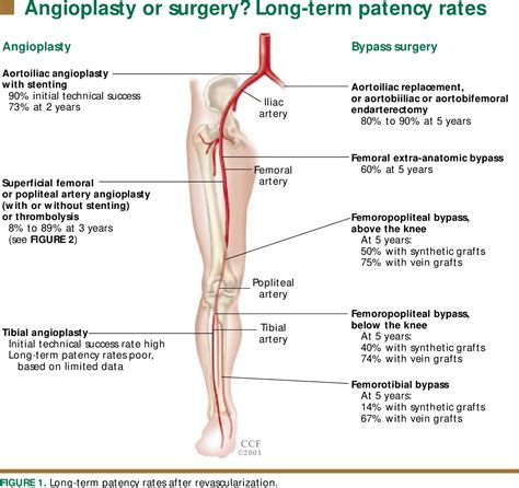 Figure 1 from PERIPHERAL VASCULAR DISEASE MUKHERJEE AND YADAV ...