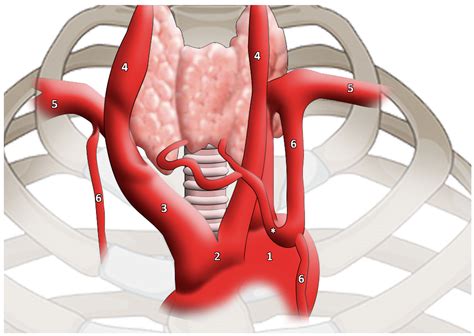 Thyroid Ima Artery