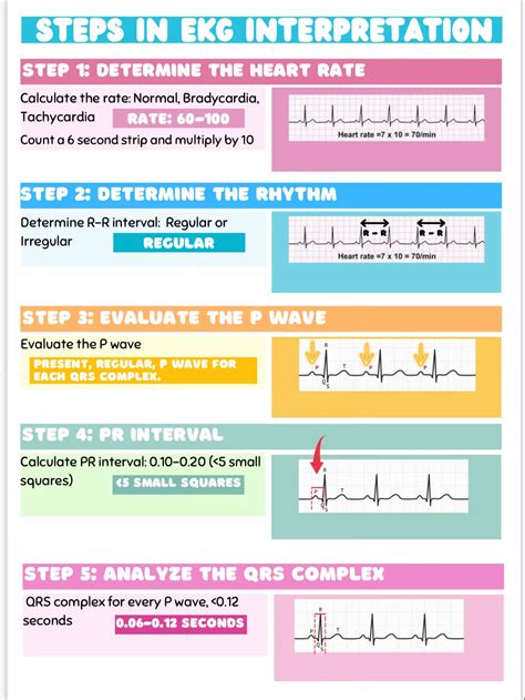 EKG cheat sheets | Gallery posted by Hailey | Lemon8