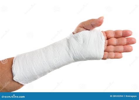 Broken Arm With A Plaster Cast Stock Images - Image: 28533204