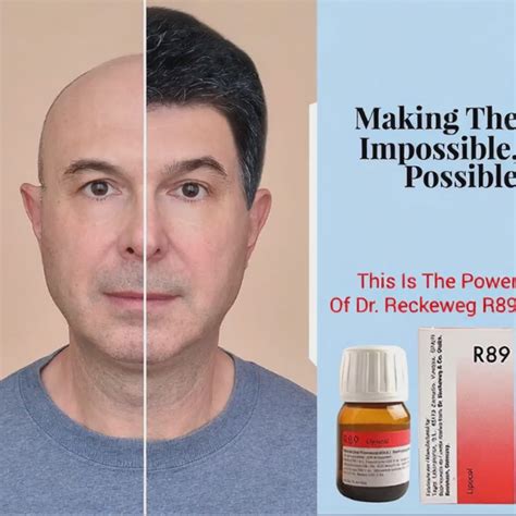 Buy Dr. Reckeweg R89 Hair Drops - Homeopathic Remedy for Hair Loss ...
