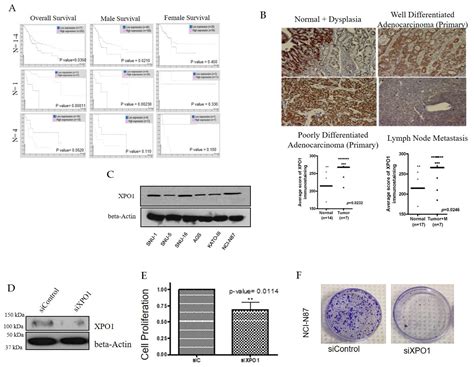 Targeting Nuclear Exporter Protein XPO1/CRM1 in Gastric Cancer