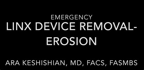 Image result for Linx Device