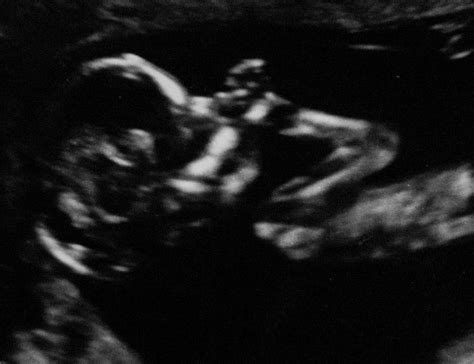 Vilhelm - Week 36, a prenatal concert