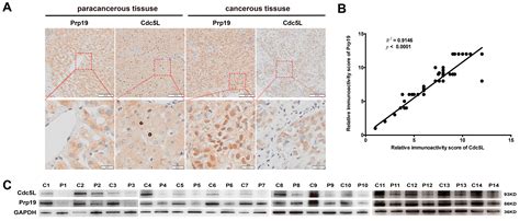 Prp19 Arrests Cell Cycle via Cdc5L in Hepatocellular Carcinoma Cells