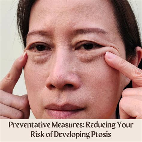 Droopy Eyelids (Ptosis): Causes, Treatments | Clinikally