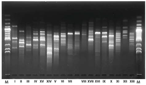 Yeast Microbiota during Sauerkraut Fermentation and Its Characteristics