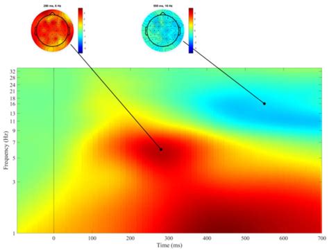 Associations of Hyperactivity and Inattention Scores with Theta and ...