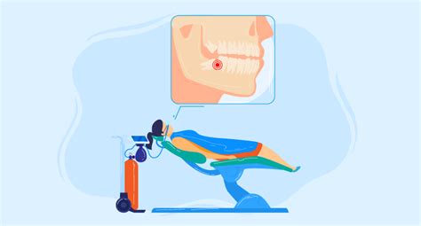 Image result for Single Tooth Root Nerve Block