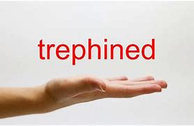 Image result for trephined