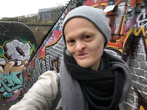 Image result for Alien Self Disorder Akbar