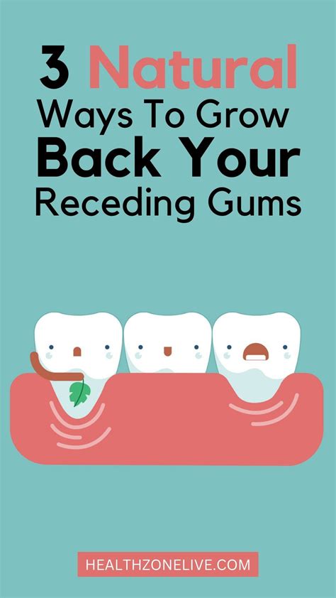 3 Natural Ways To Grow Back Your Receding Gums | Grow back receding gums, Receding gums, Reverse ...