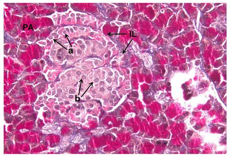 Efficiency of Bone Marrow-Derived Mesenchymal Stem Cells and Hesperetin ...