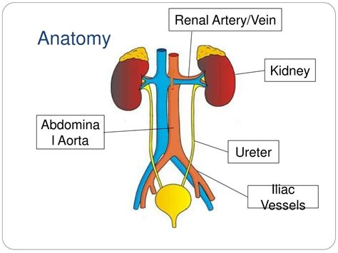 Image result for Hand-Assisted Nephrectomy