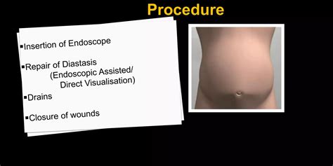 Endoscopically Assisted Repair of Diastasis Rectii by Dr Sumita Shankar, Amaze MedSpa | PPT