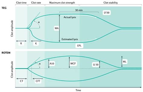 Severe Trauma-Induced Coagulopathy: Molecular Mechanisms Underlying ...